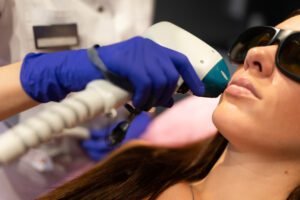 Benefits of Laser Treatment - Midas Aesthetics