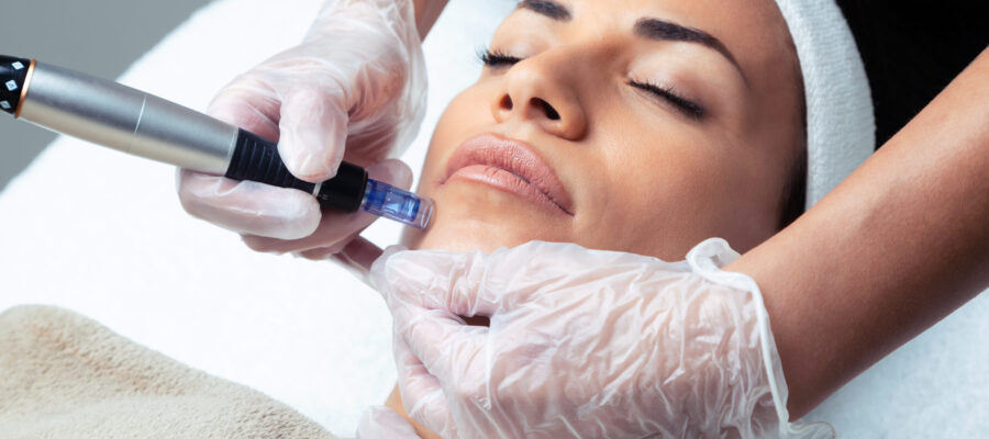 Vampire Facial Treatment in Borivali, Mumbai