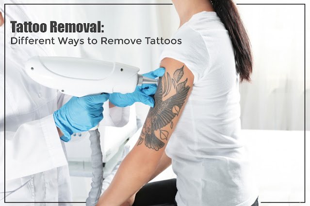 Ways to Remove Tattoos