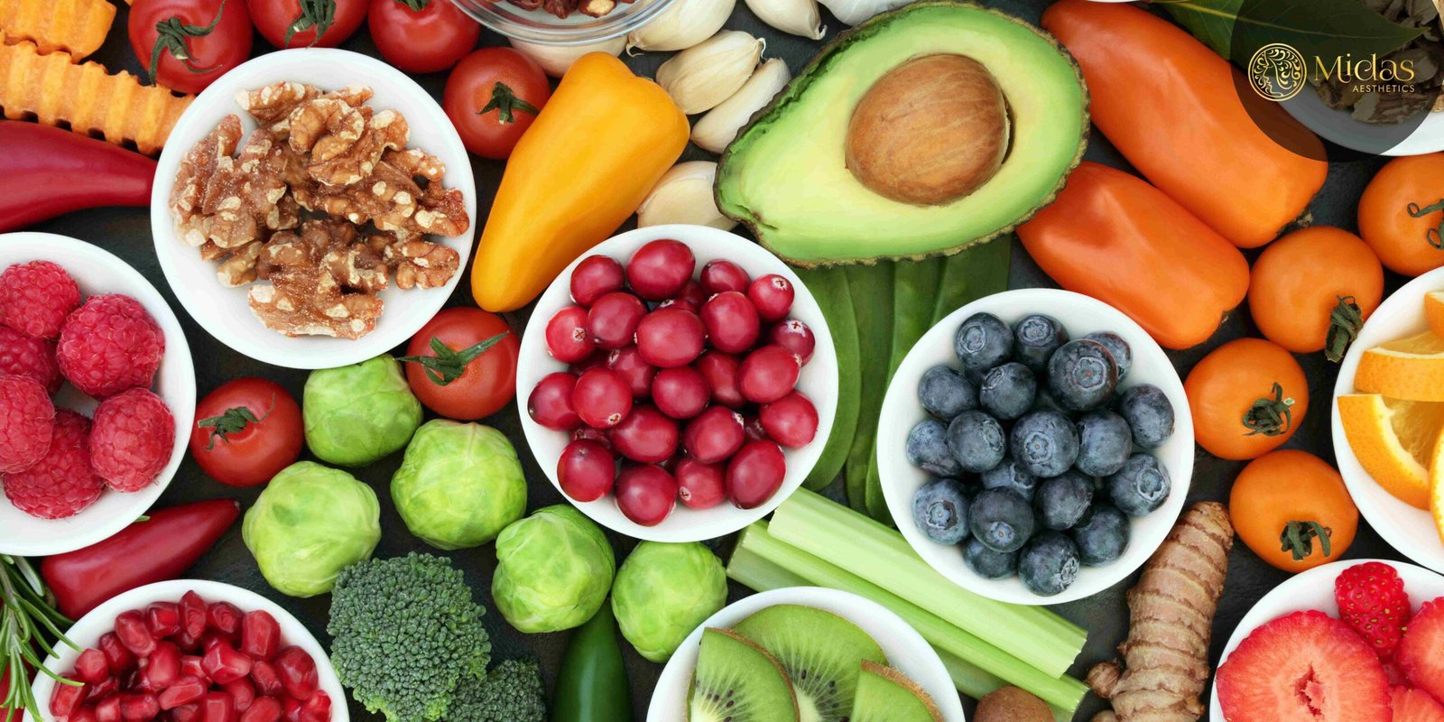 How to Prevent Acne - 5 Superfoods to help- Midas Aesthetics