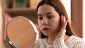 Causes of Skin Pigmentation - Midas Wellness Hub