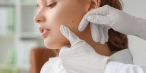 Pigmentation Removal Treatment in Borivali, Mumbai - Midas Wellness Hub