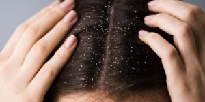 Hair Treatment Services - Midas Wellness Hub