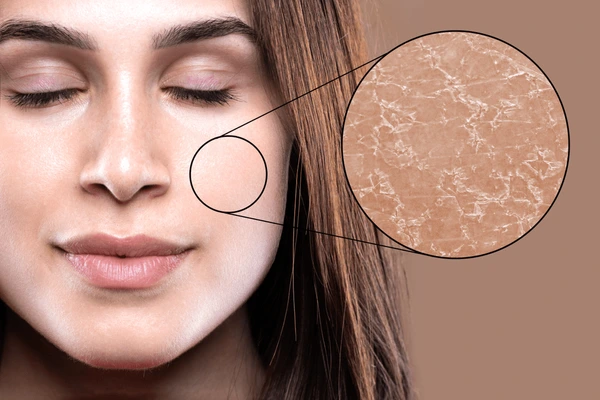 Dehydrated Skin vs. Dry Skin: How to Tell the Difference & Fix It