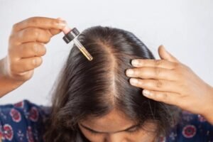 Is Minoxidil Really Safe for Hair Loss? The Truth You Need to Know