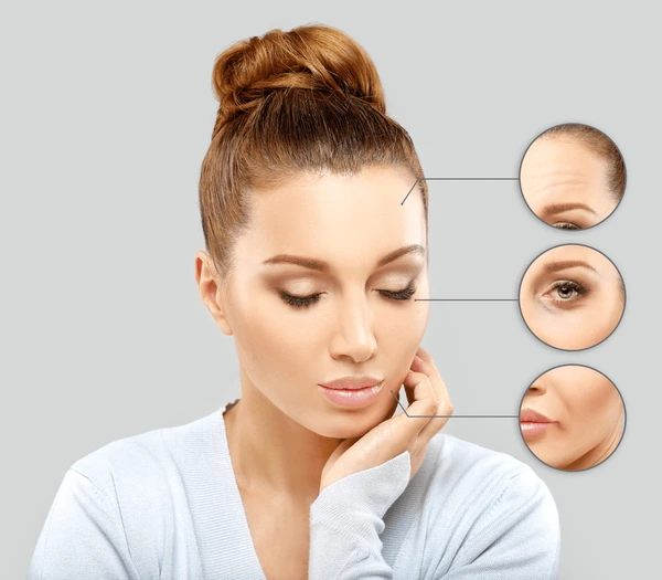 Smart Women Are Choosing Botox in Their 30s & 40s