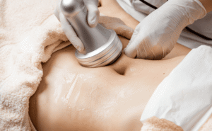 Reclaim Your Confidence with Ultrasound Cavitation: Mumbai’s Non-Surgical Solution