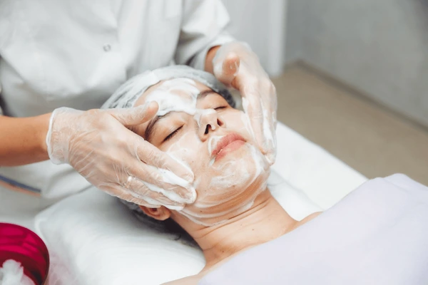 Skin Peels for Pigmentation