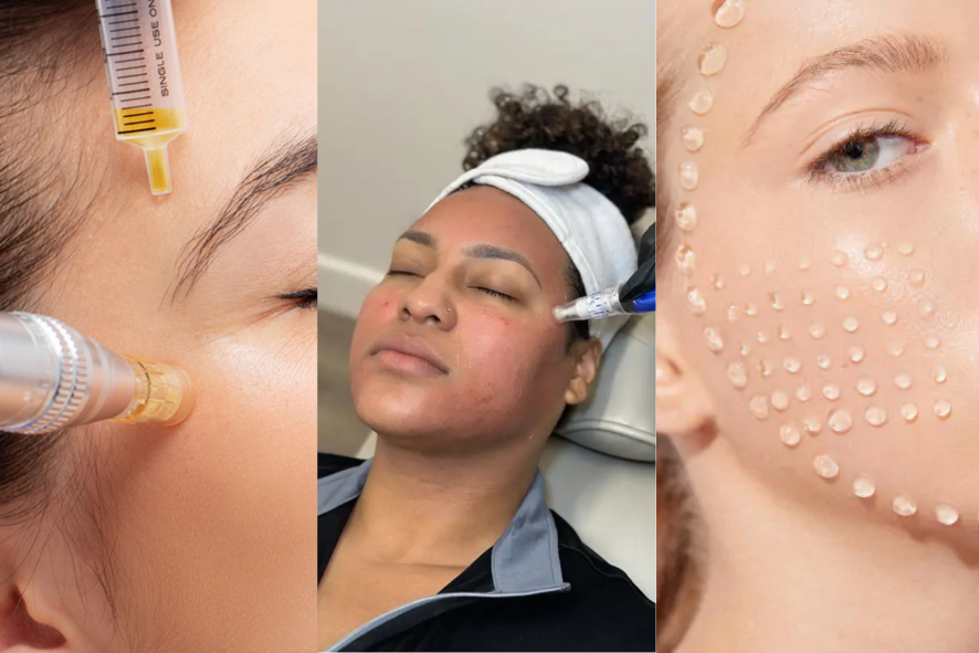 Skin Boosters, PRP & Microneedling at Midas Wellness Hub, Borivali: Are They Worth It?