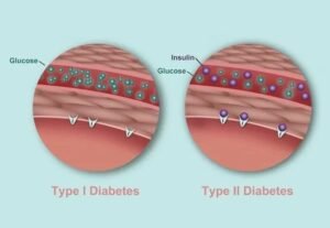 Mounjaro (Tirzepatide): A Transformative Approach to Diabetes and Weight Loss 