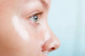 The Future of Skin Regeneration: Exosomes vs. PDRN in Borivali