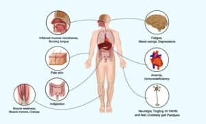 Vitamin D & B12 Deficiency: The Hidden Cause Behind Skin Issues and Weight Gain