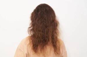 Root Deep Treatment in Borivali: A Natural Solution to Dandruff and Hair Fall