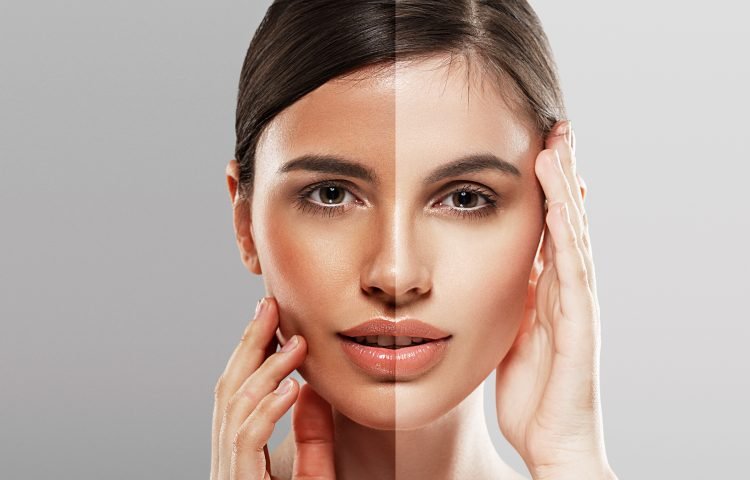 Laser Toning and Q-Switch Treatment for Pigmentation and Tan Removal: Now Available at Midas in Borivali