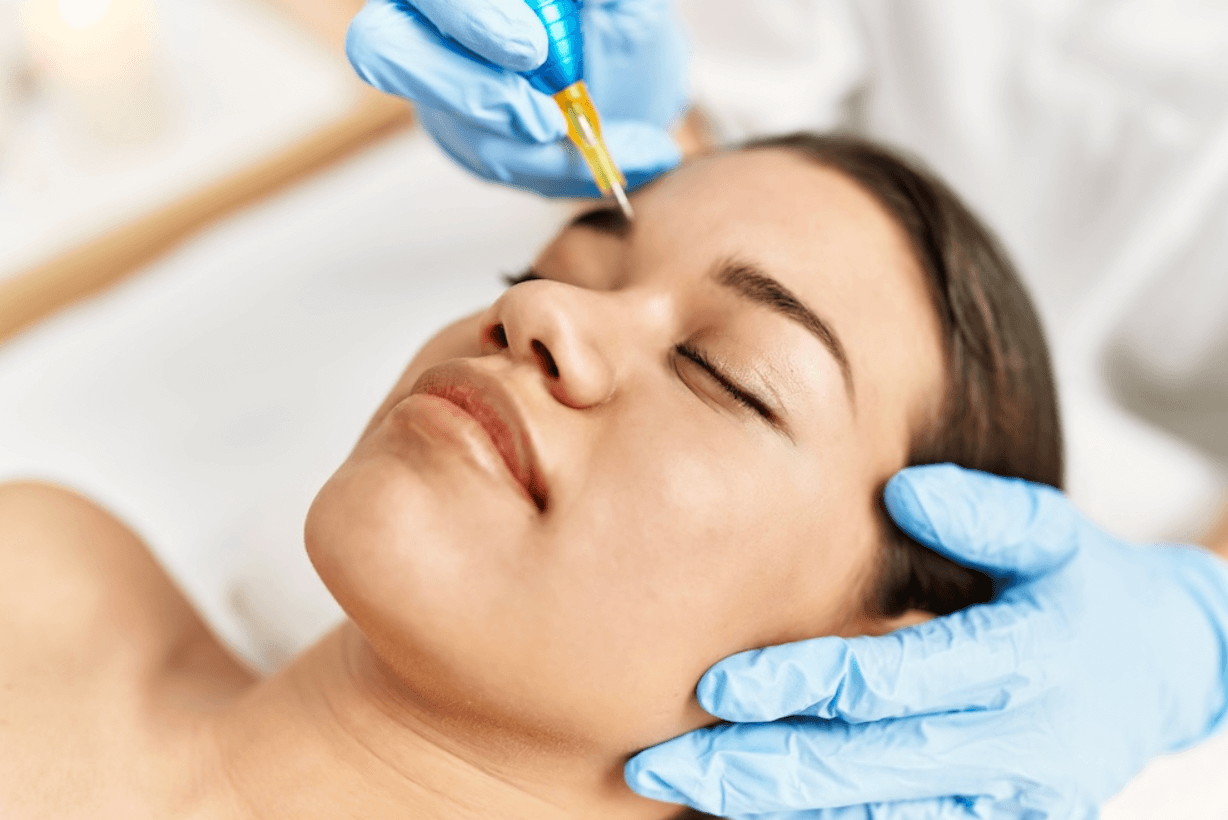 Microblading Eyebrows – The Art of Perfect, Effortless Brows at Midas Wellness Hub