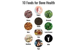 Bone Aches After 30? How Functional Medicine and Diet Can Strengthen Women’s Bones