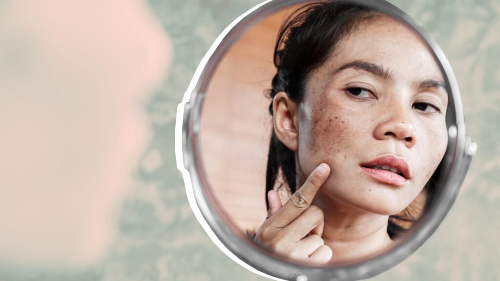 Dark Spots, Pigmentation & Sagging: The Top 3 Skin Concerns Women Face After 40 (And How to Treat Them)