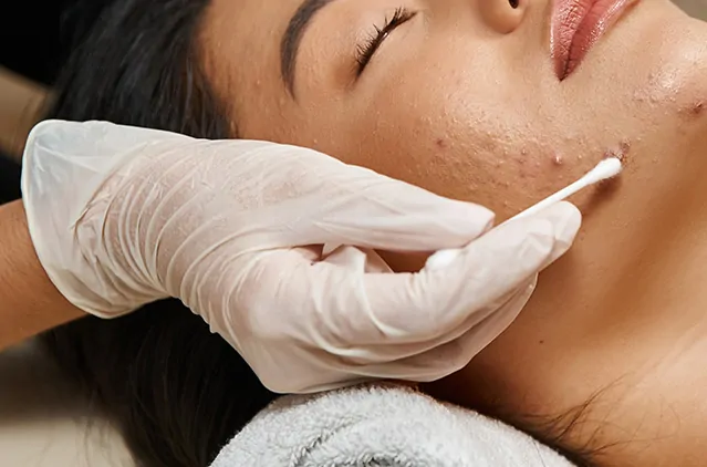 [1:38 pm, 4/10/2025] Shakshi Davadra: As discussed setting hair transplant ad for awareness [2:13 pm, 4/10/2025] Shakshi Davadra: Pico Laser vs. Chemical Peels & Microneedling: Which Works Best for You?