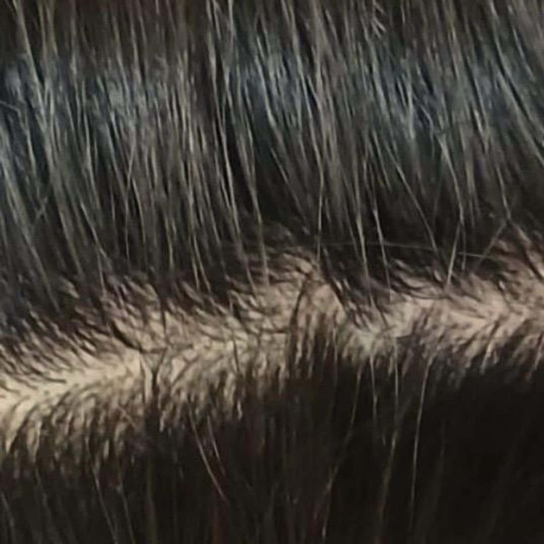 After image