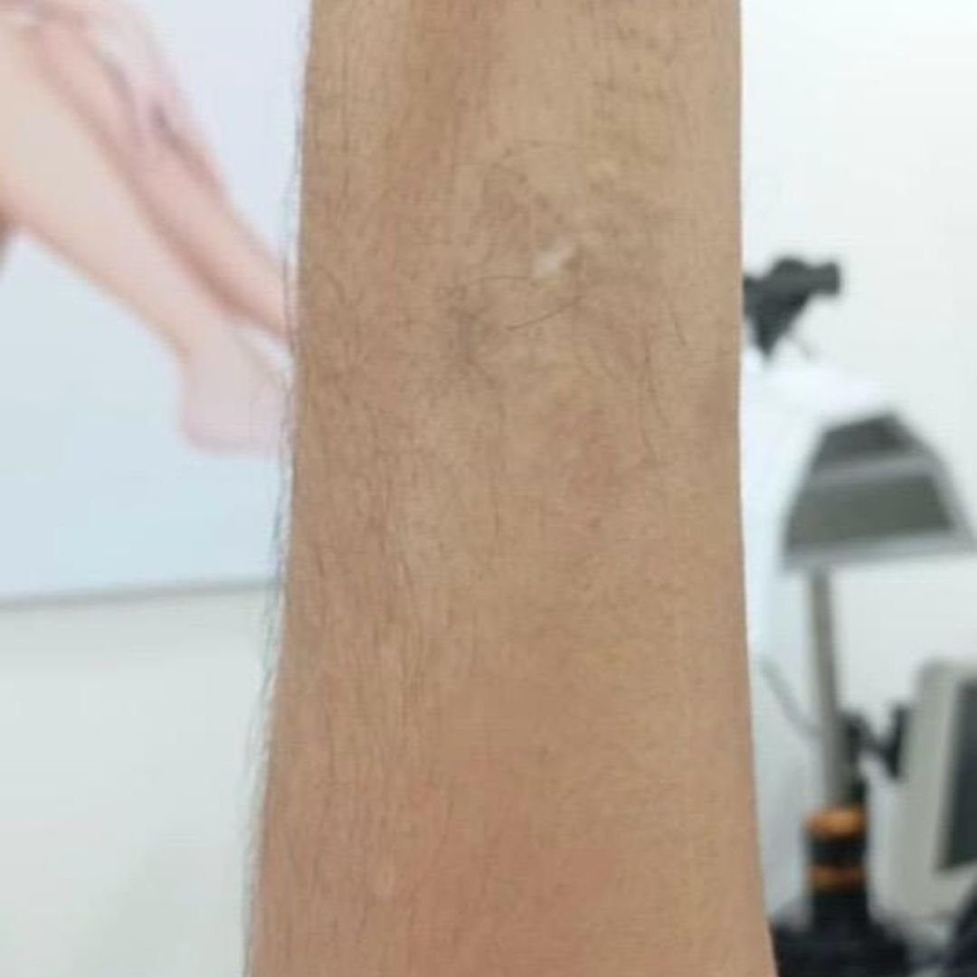 After image