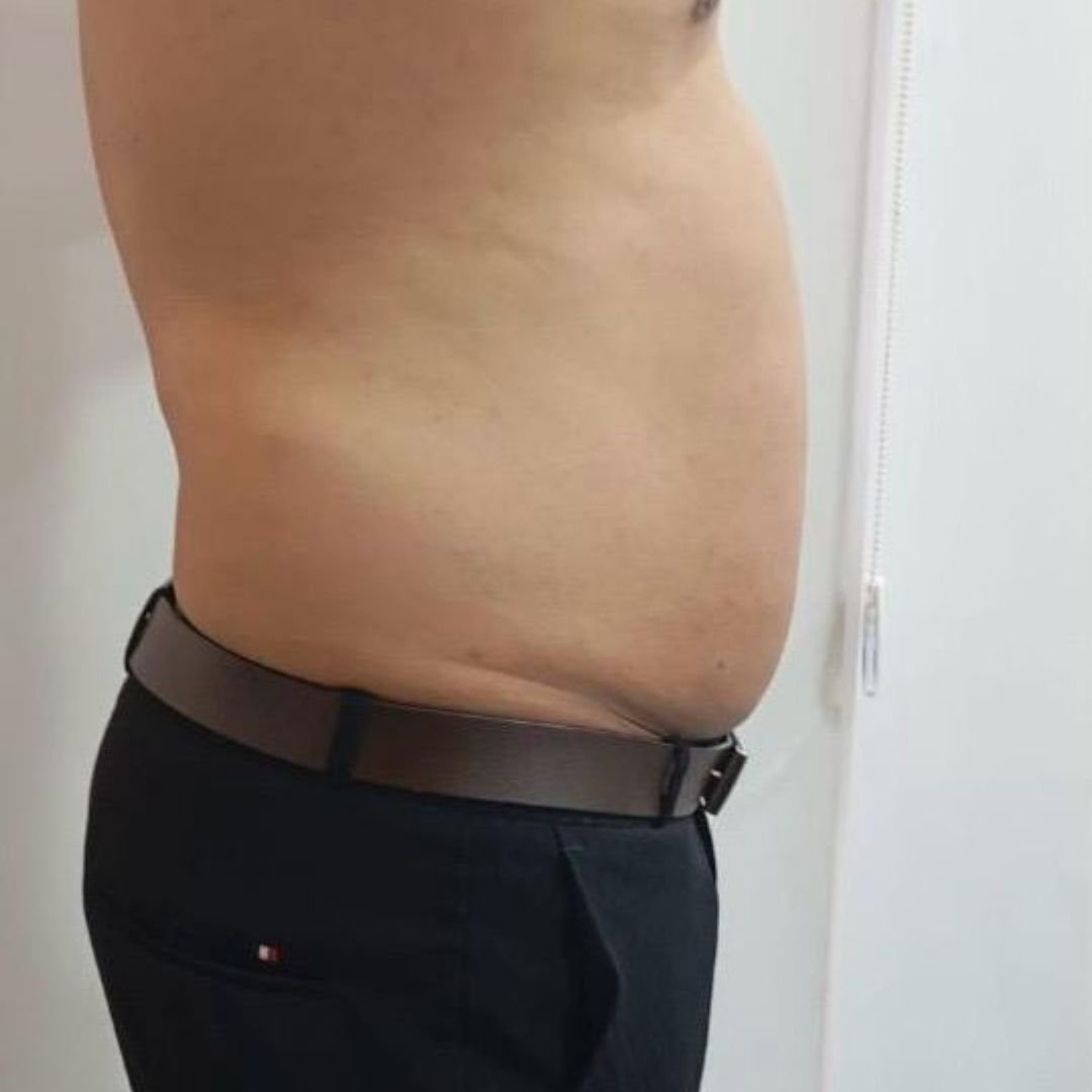After image