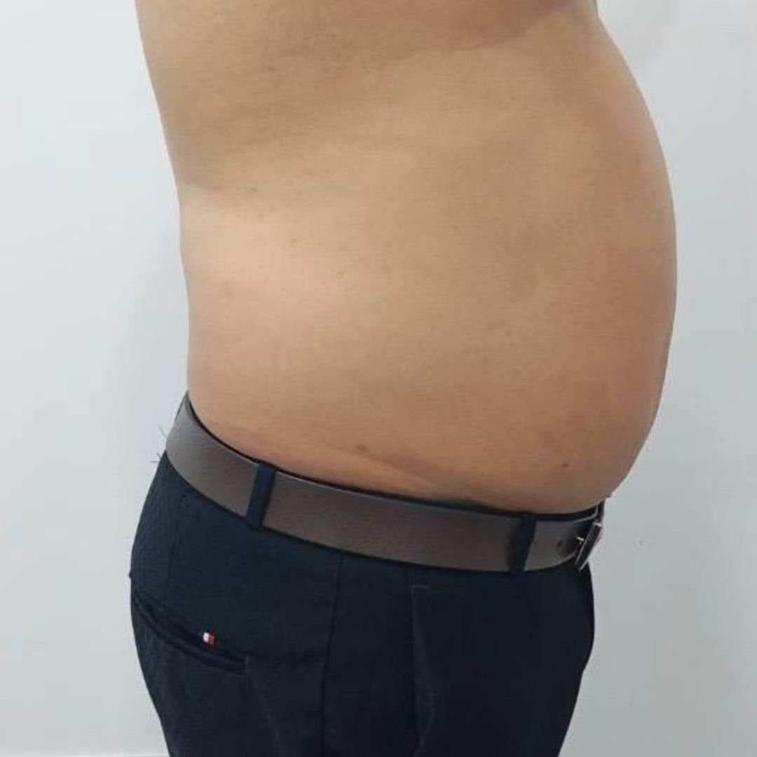 Before image