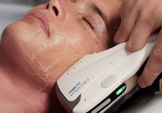 Men Want to Look Sharp Too: How HIFU and Cryo Are Redefining Male Aesthetics