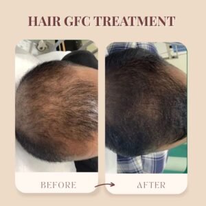 Hair GFC| Midas Wellness Hub