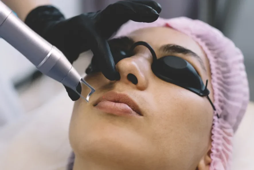 Best Laser Treatments for Scars, Pigmentation & Anti-Aging in December 2025