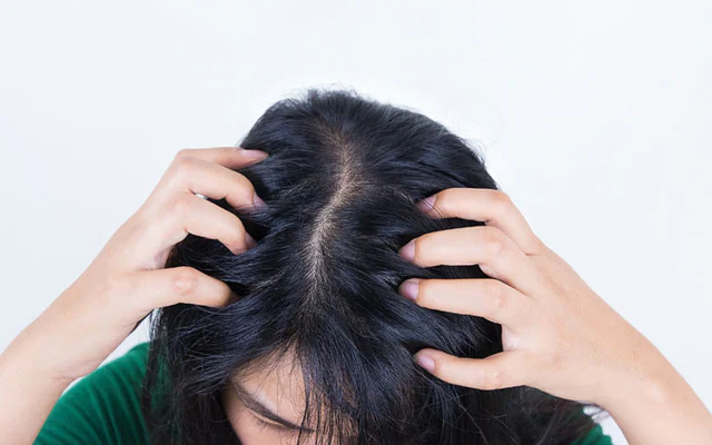 Dry Scalp, Dandruff & Itching: Root Causes Explained & the Best Treatment Approach