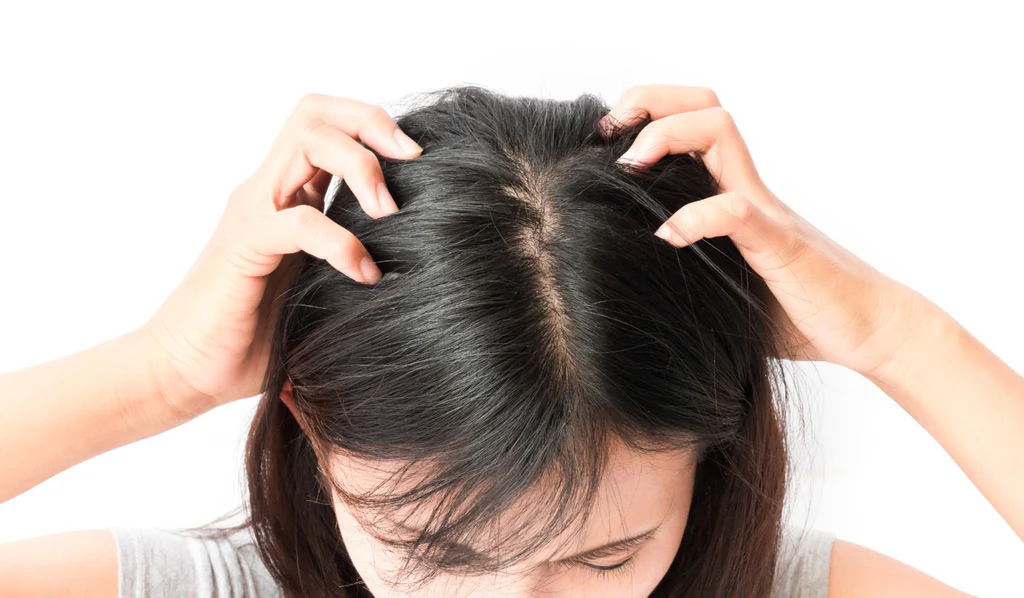 Top 5 Causes of Hair Thinning and How to Reverse Them Naturally with Functional Medicine