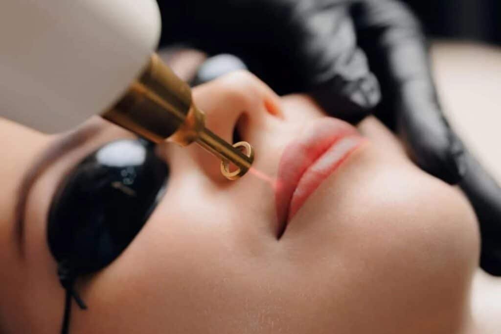 5 Signs Your Lip Pigmentation Needs Medical Treatment