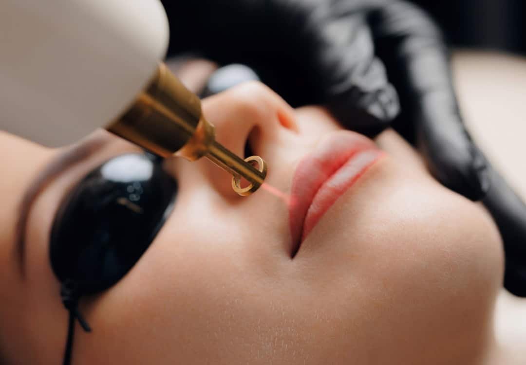 5 Signs Your Lip Pigmentation Needs Medical Treatment