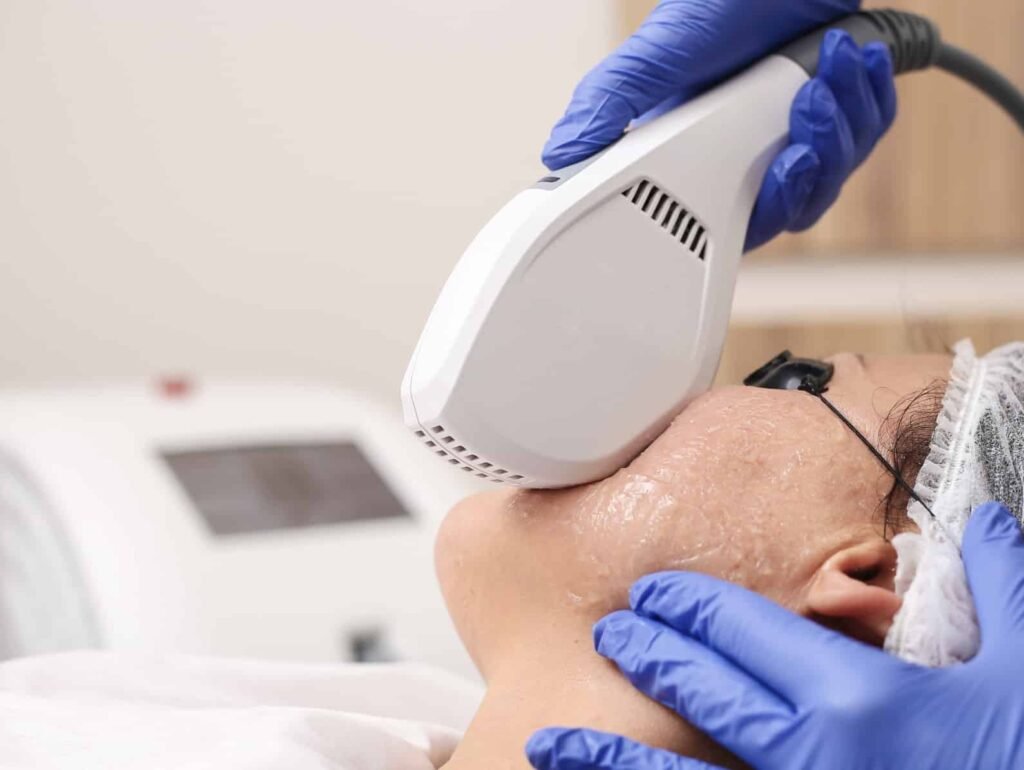 IPL Treatment (Intense Pulsed Light): Clear, Calm & Confident Skin – The Midas Wellness Hub Way