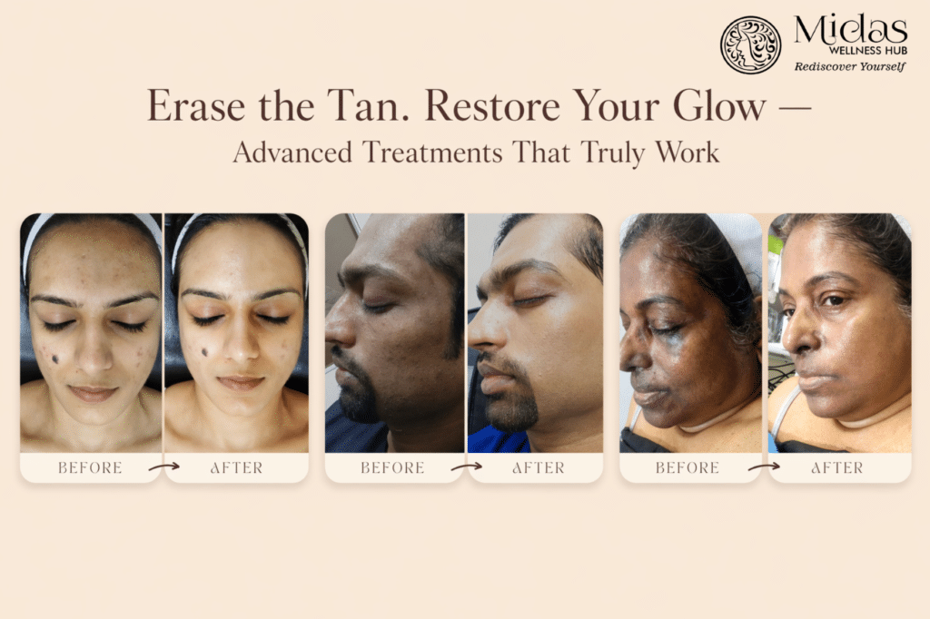 After skincare treatment image showing clear, glowing, and healthy skin with improved texture, even tone, and strengthened skin barrier reflecting visible results of consistent care.