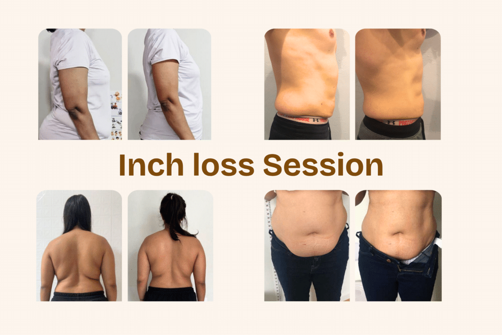 Before and after inch loss treatment results in Borivali